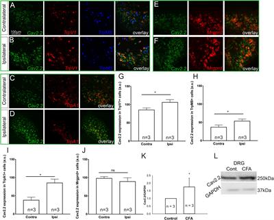 Inflammation Induced Sensory Nerve Growth and Pain Hypersensitivity Requires the N-Type Calcium Channel Cav2.2